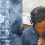 নোয়াখালী হাসপাতালে রোগী সেজে চুরির চেষ্টা, এক্সরেতে মিলল পেটের ভেতর স্বর্ণের চেইন